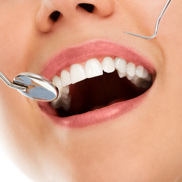 Rehabilitación Oral