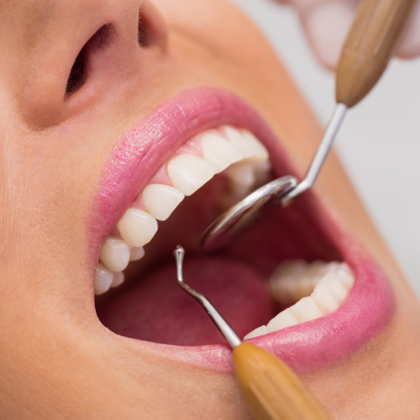Armonizacion Facial